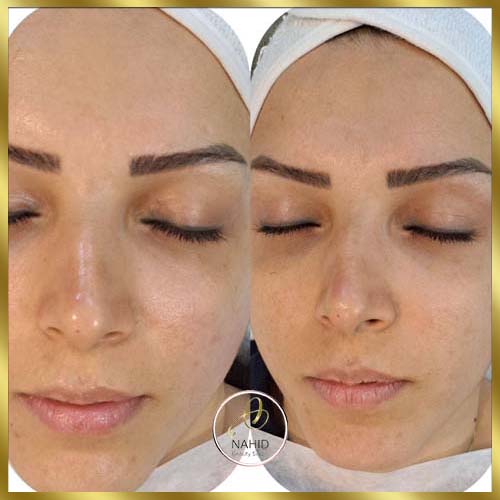 گالری پاکسازی پوست